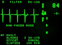 electrocardiogram-16948_640