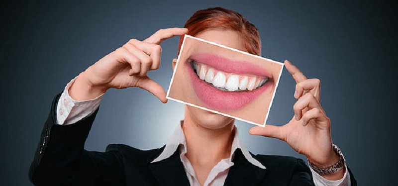 Vše co byste měli vědět o bělení zubů